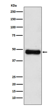 ADK Rabbit mAb [KD Validated] Antibody