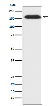 SUPT5H Rabbit mAb [KD Validated] Antibody