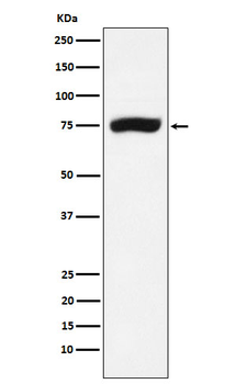 XPD Rabbit mAb Antibody