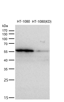 P4HB Rabbit mAb [KD Validated] Antibody