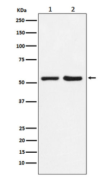 P4HB Rabbit mAb [KD Validated] Antibody