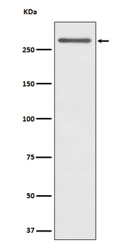 CD35 Rabbit mAb Antibody