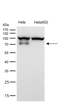 GLB1 Rabbit mAb [KD Validated] Antibody