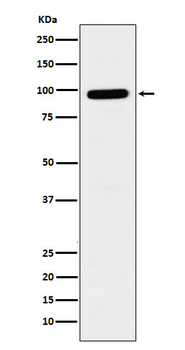 GLB1 Rabbit mAb [KD Validated] Antibody