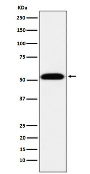 TEAD1 Rabbit mAb [KD Validated]