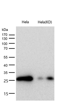 CLPP Rabbit mAb [KD Validated] Antibody