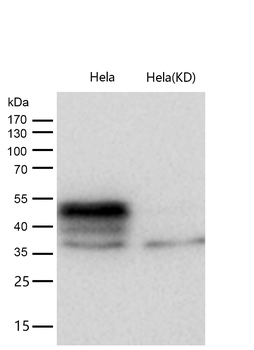 TEAD1 Rabbit mAb [KD Validated]