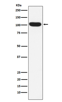 ITCH Rabbit mAb Antibody