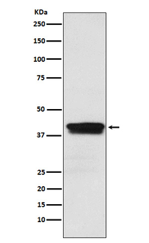 MBNL1 Rabbit mAb Antibody
