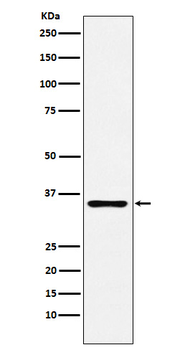 DCR2 Rabbit mAb Antibody