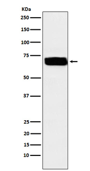 Poliovirus Receptor Rabbit mAb [KD Validated]