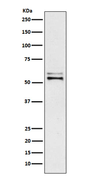 Angiotensinogen Rabbit mAb Antibody