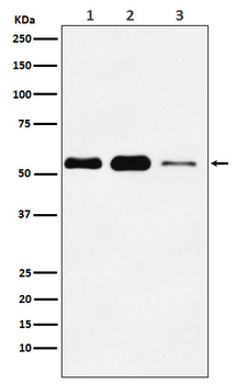 ATGL/PNPLA2 Rabbit Monoclonal Antibody