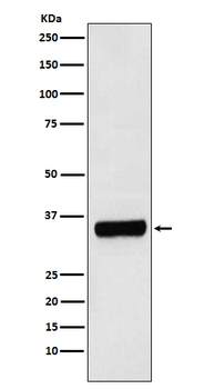 PRKRA Rabbit mAb [KD Validated]