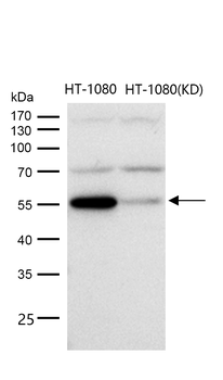TXNRD2 Rabbit mAb [KD Validated] Antibody