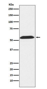 TXNRD2 Rabbit mAb [KD Validated]