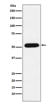 CBX4 Rabbit mAb Antibody