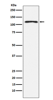 HLTF Rabbit mAb [KD Validated]