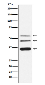 Legumain Rabbit mAb [KD Validated]