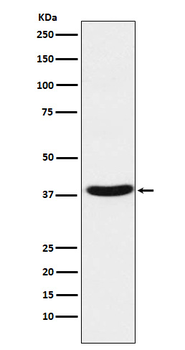 MT-ND1 Rabbit mAb Antibody