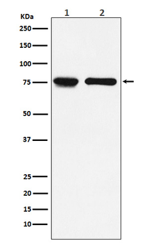 IL7R alpha/CD127 Rabbit mAb Antibody