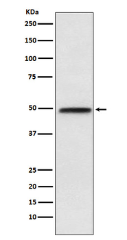 NFIB / NF1B2 Rabbit mAb