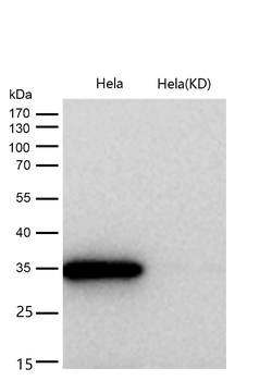 NEK7 Rabbit mAb [KD Validated] Antibody