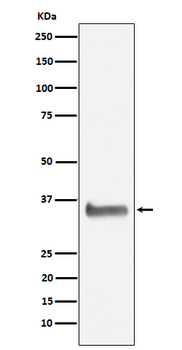 NEK7 Rabbit mAb [KD Validated] Antibody