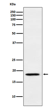 MTH1 Rabbit mAb [KD Validated]