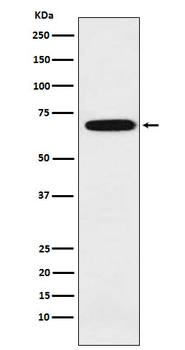 IKZF3 Rabbit mAb Antibody