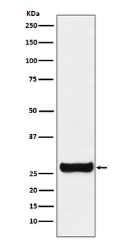 GSTM1 Rabbit Monoclonal Antibody