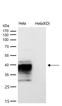 ATP1B3 Rabbit mAb [KD Validated]