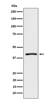 ATP1B3 Rabbit mAb [KD Validated]