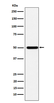 ABAT Rabbit mAb Antibody