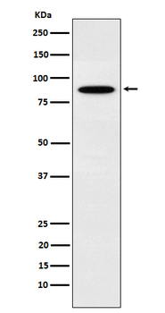 EWSR1 Rabbit mAb Antibody