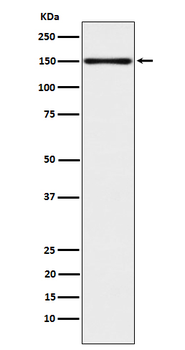 CLSTN1 Rabbit mAb [KD Validated]