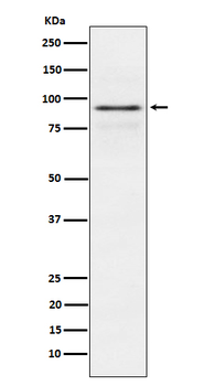 RSK1 p90 Rabbit mAb Antibody