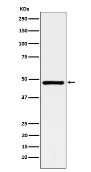 ACADM Rabbit mAb Antibody
