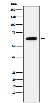 Estrogen Receptor alpha Rabbit mAb Antibody