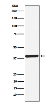 CaMKI Rabbit mAb Antibody