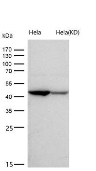 KAT1 / HAT1 Rabbit mAb [KD Validated]