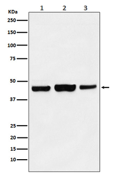 KAT1 / HAT1 Rabbit mAb [KD Validated]
