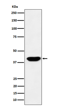 Islet1 Rabbit mAb Antibody