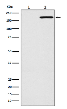 EGFR(L858R mutation) Rabbit mAb Antibody
