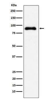 SATB2 Rabbit mAb Antibody