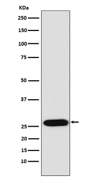 LIN28 Rabbit mAb