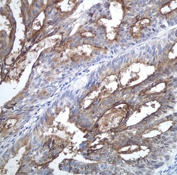 CA125 / MUC16 Rabbit mAb Antibody