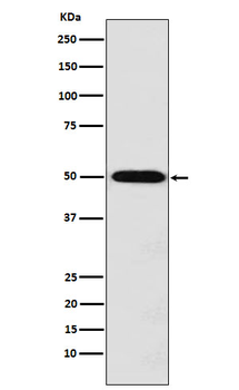 MCT1 Rabbit Monoclonal Antibody