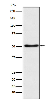 SFRP4 Rabbit mAb Antibody