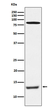 PEN2 Rabbit mAb Antibody